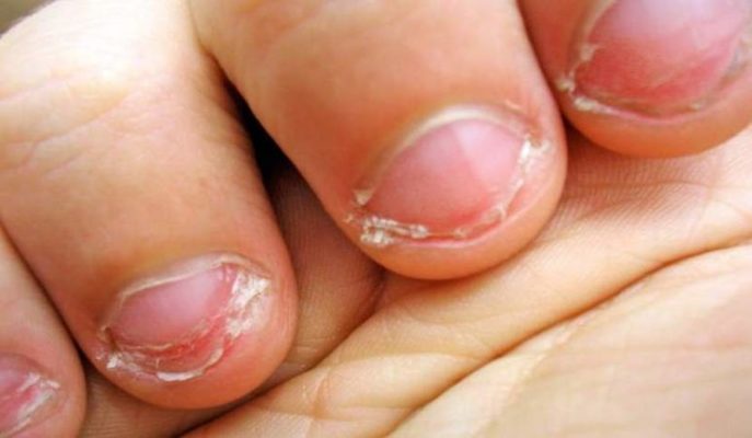¿Es bueno para la salud morderse las uñas? 26 Merca2.es morderse las unas un nene
