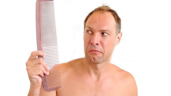 calvicie o que saber sobre ela Merca2.es