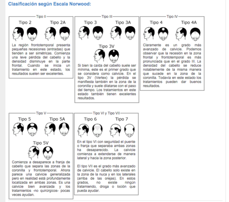 calvicies segun Escala Norwood Merca2.es