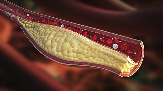 ¿Son un fraude los alimentos para reducir el colesterol? 1 Merca2.es Colesterol