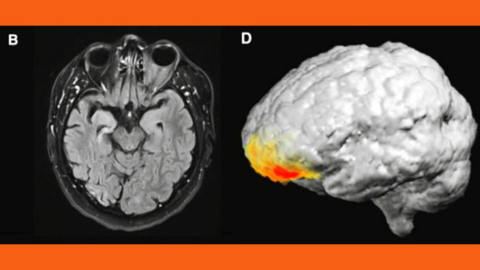 ¿Existe un vínculo entre la epilepsia y las experiencias religiosas? 38 Merca2.es Experiencias religiosas
