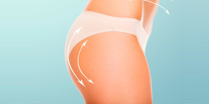 Las 10 cirugías plásticas más caras a las que te puedes someter 5 Merca2.es gluteos e1493558860650 Merca2.es