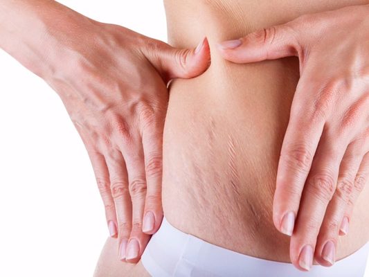La celulitis en los hombres también existe 1 Merca2.es celulitis