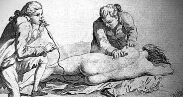 Cuando soplar en el culo era una práctica médica habitual