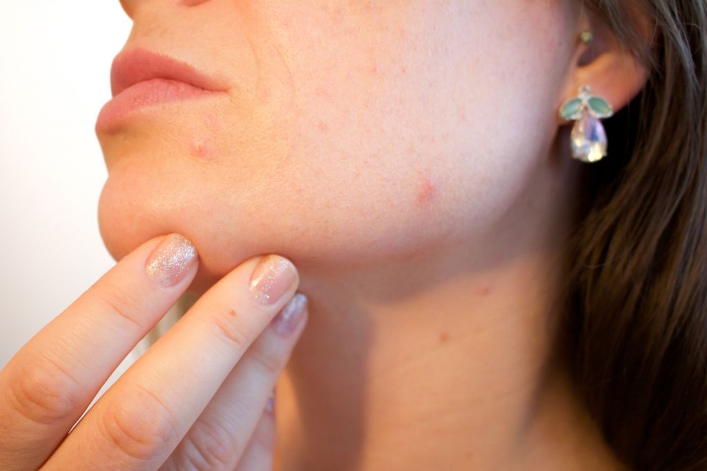 acne-mascarilla