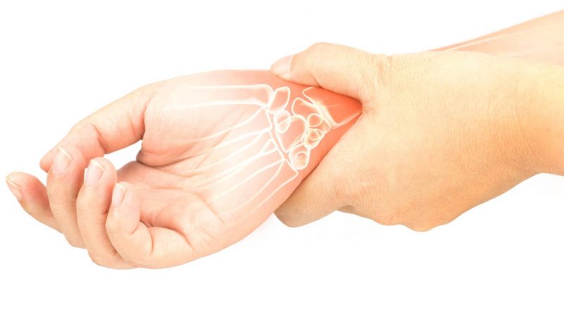 Artrosis, artritis, estas son las diferencias entre ambas 3 Merca2.es artrosis artritis