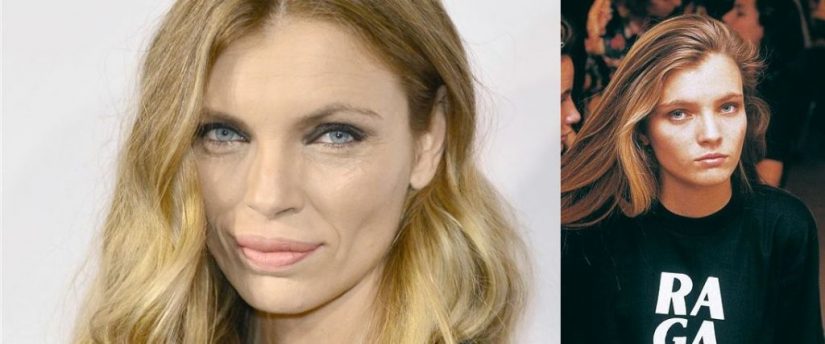 Ester Cañadas famosas y cirugía