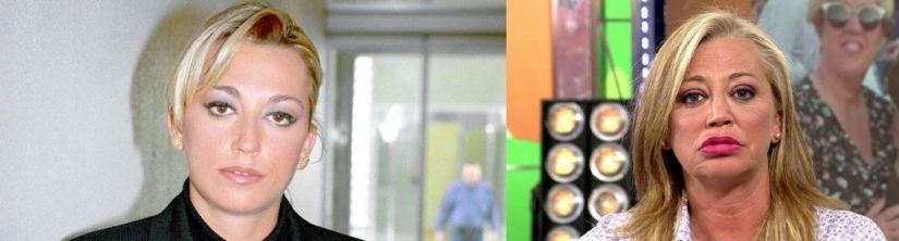 famosas con cirugía Belén Esteban