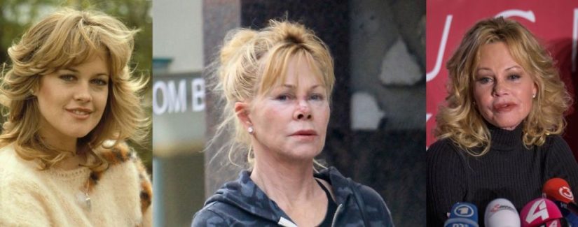 famosas por cirugía Melanie Griffith 