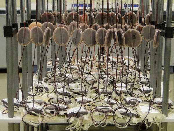 bolsas de sangre anemia