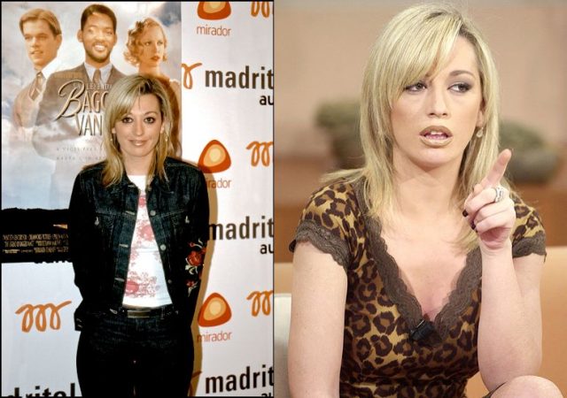 Primeras operaciones de Belén Esteban 