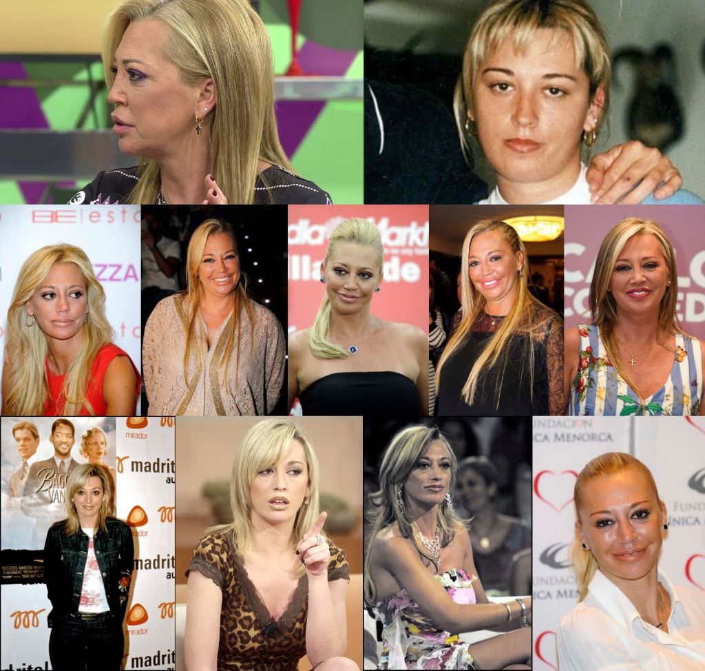 Todos los retoques y cirugías que se ha hecho Belén Esteban