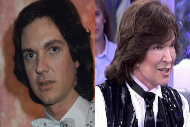 Camilo Sesto antes y después como Belén Esteban o Antonia San Juan