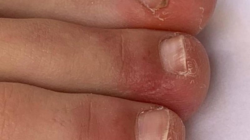 coronavirus sintomas desconocidos niños Merca2.es