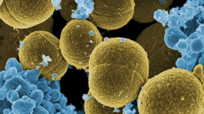 inteligencia artificial contra superbacterias
