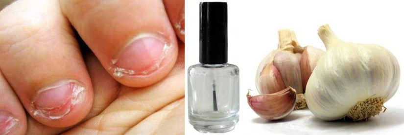 xunego blog 12.07.2015 morderunas ajo 949x319 1 Merca2.es