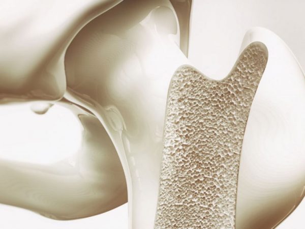 masa osea mesa redacción 2 Merca2.es