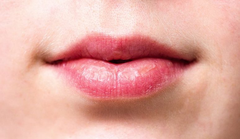 Hidratar los labios con aceite de coco Mercadona cosméticos