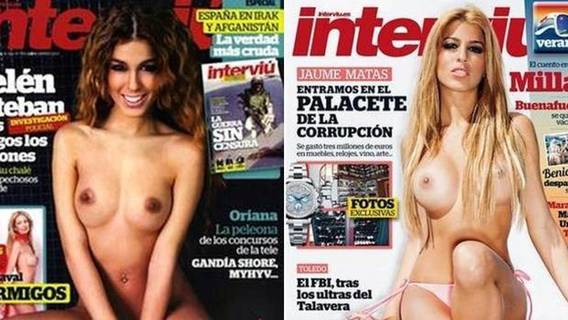 Oriana Marzoli antes y después de la operación pecho