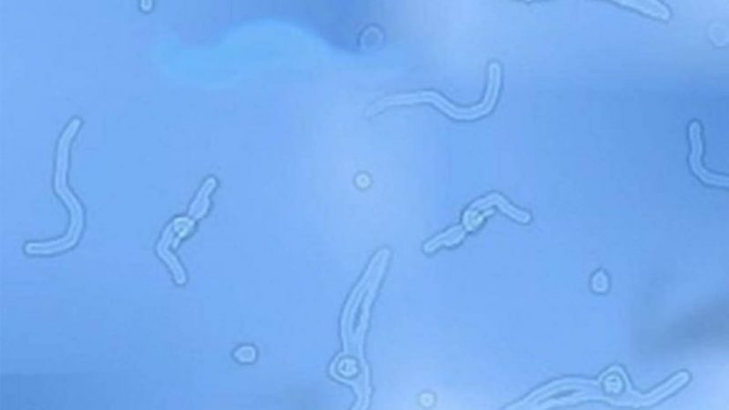 gafas vista miodesopsias