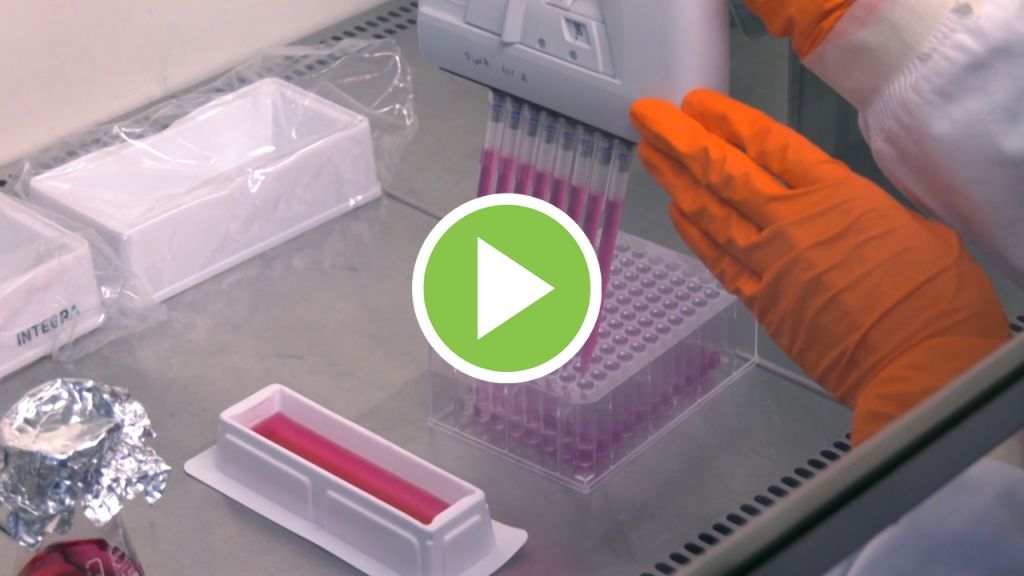 Sputnik V, la primera vacuna contra el coronavirus ya existe