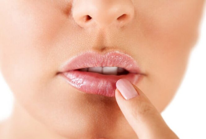 Así puedes tratar el herpes labial