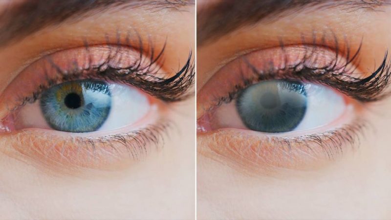 Lo que necesitas es luteína