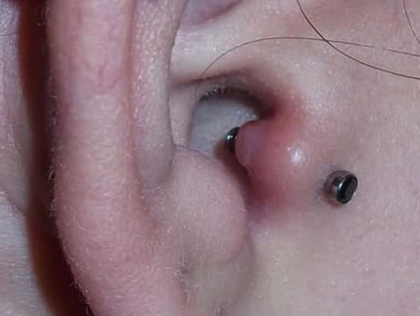 Todo lo que necesitas saber sobre el piercing tragus: riesgos y recomendaciones 24 Merca2.es Cómo prevenir infecciones