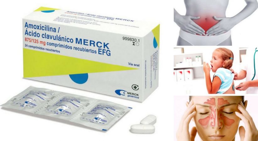¿Cuáles son los efectos secundarios que puede tener la amoxicilina?