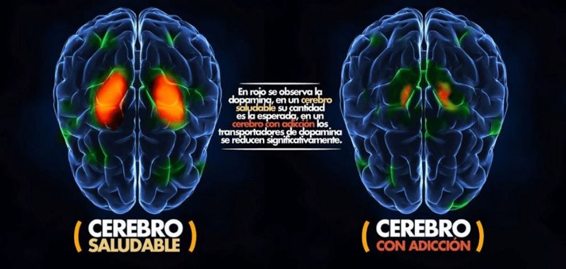 ¿Cuáles son los efectos sobre el cerebro?