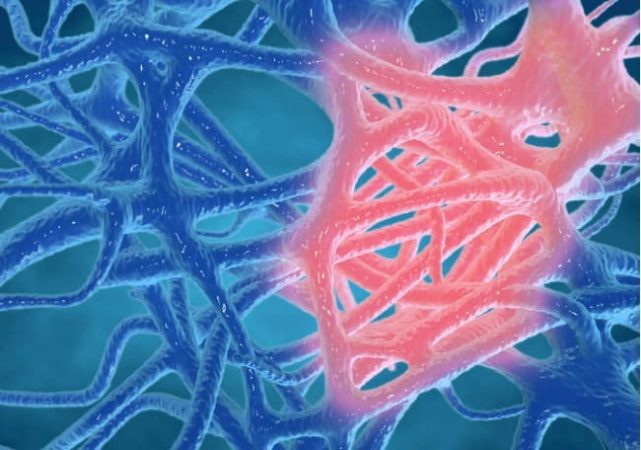 ¿Cuál es el vínculo causal entre obesidad e inflamación?