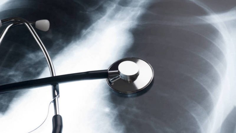 Neumonía: los síntomas más claros de que padeces esta enfermedad 68 Merca2.es Complicaciones de la neumonía