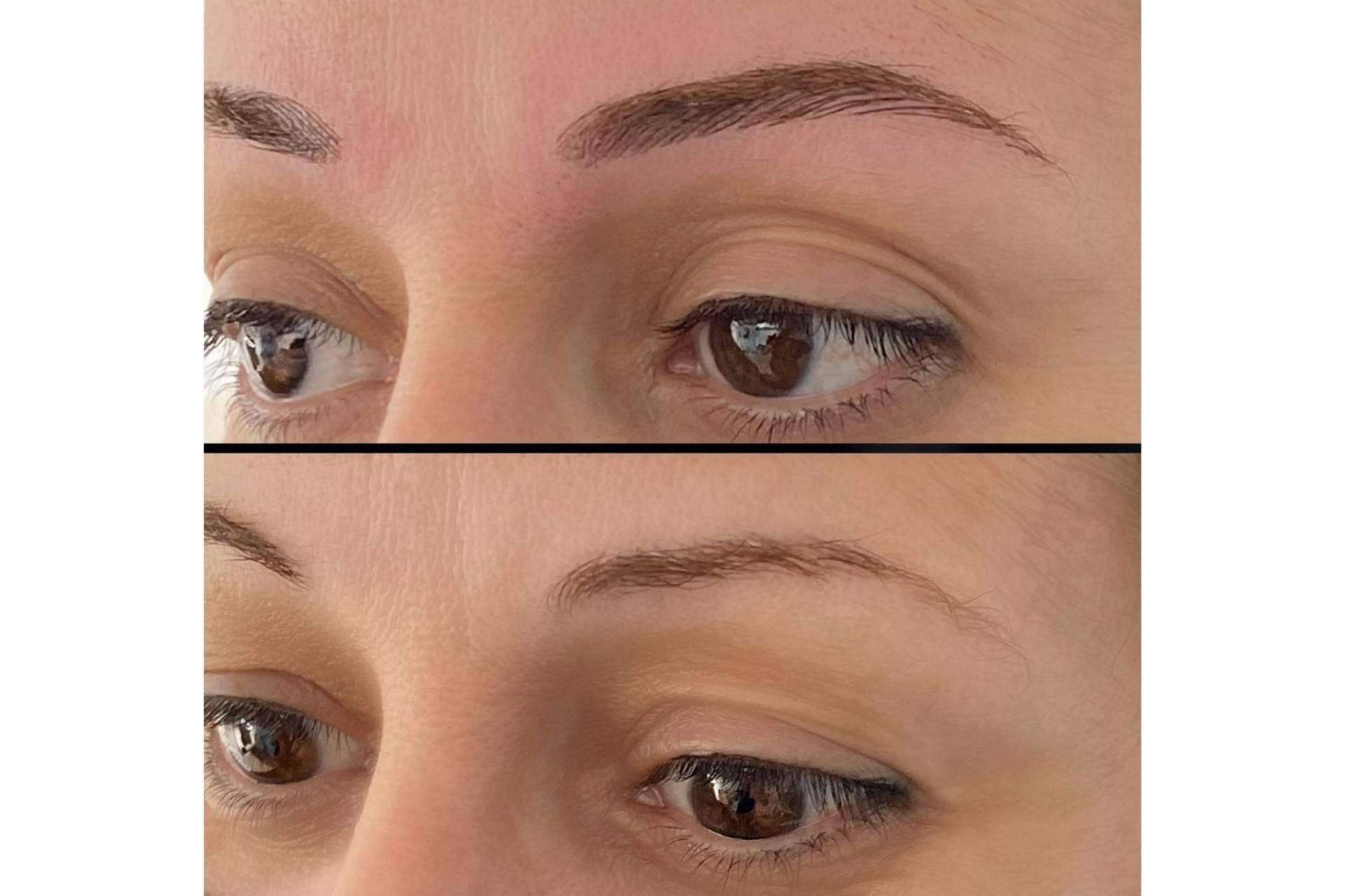 Lucir un rostro siempre perfecto con el microblading de la Dra. Julieta Gil