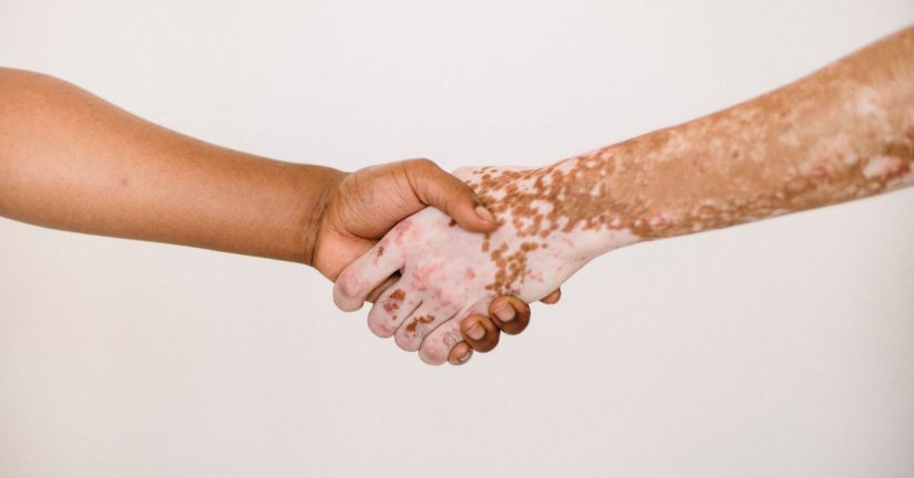 Estas son las razones por las que tienes tantas canas 8 Merca2.es canas