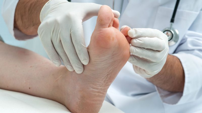 Trucos para acabar con los pies secos o agrietados 16 Merca2.es Consultar al médico pies