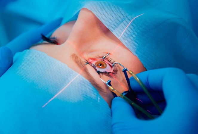 ¿De qué se trata la operación en términos clínicos?