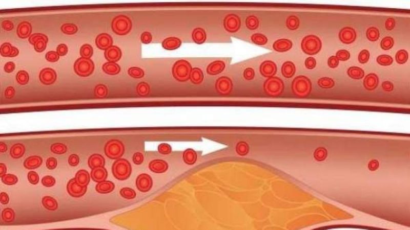 Reduce la presion arterial Merca2.es