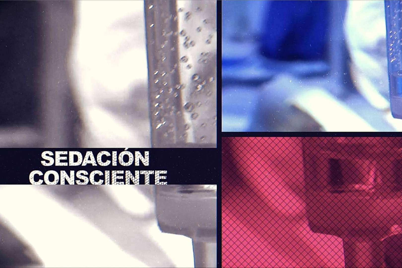 Sedación consciente en la clínica dental Formación en Implantología para pacientes con fobia al dentista Sedación consciente en la clínica dental Formación en Implantología para pacientes con fobia al dentista