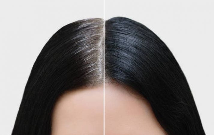 Prueba el champú anticanas