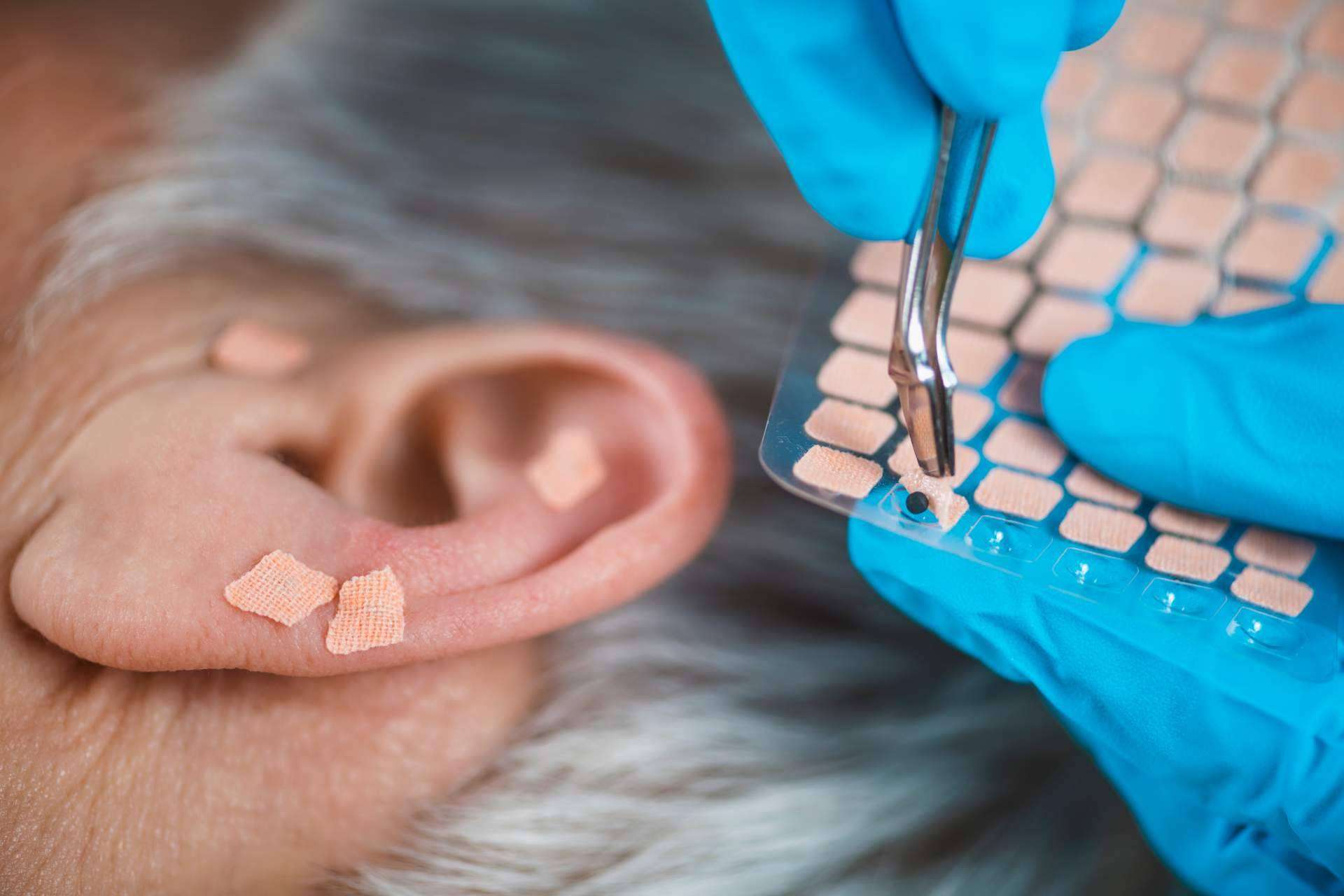 Auriculoterapia, la técnica natural coadyuvante en el tratamiento del dolor, ansiedad y adicciones de Rambla 6 Auriculoterapia, la técnica natural coadyuvante en el tratamiento del dolor, ansiedad y adicciones de Rambla 6