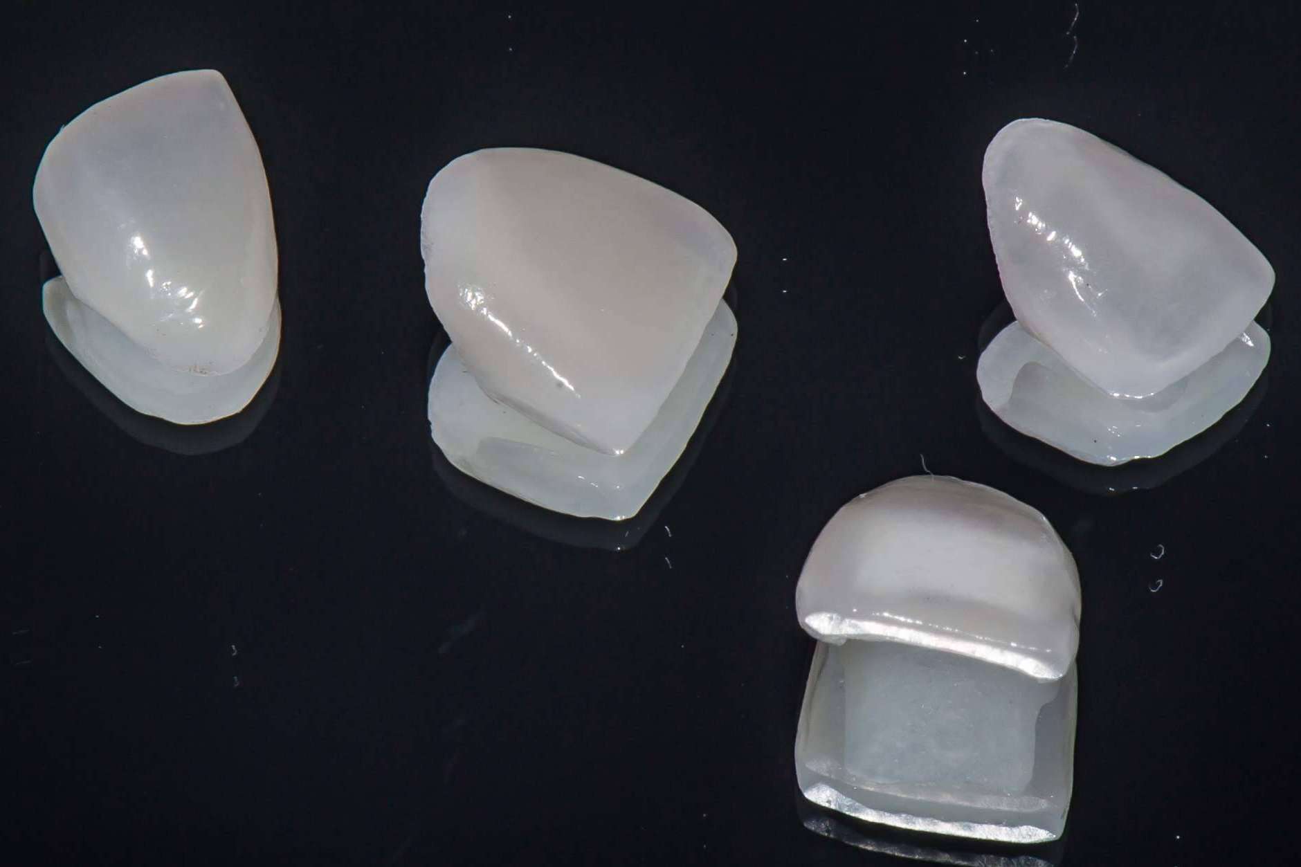 Carillas dentales de porcelana para mejorar la estética dental