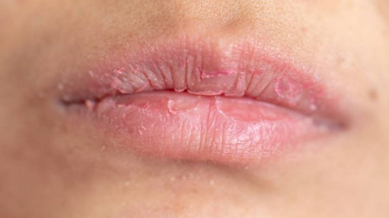 labios agrietados por el frio como curarlos con exfoliantes naturales Merca2.es