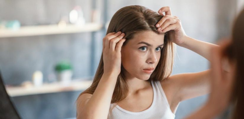 El asombroso motivo que no te creerás por el que tu pelo se puede llenar de caspa 41 Merca2.es El asombroso motivo que no te creerás por el que tu pelo se puede llenar de caspa