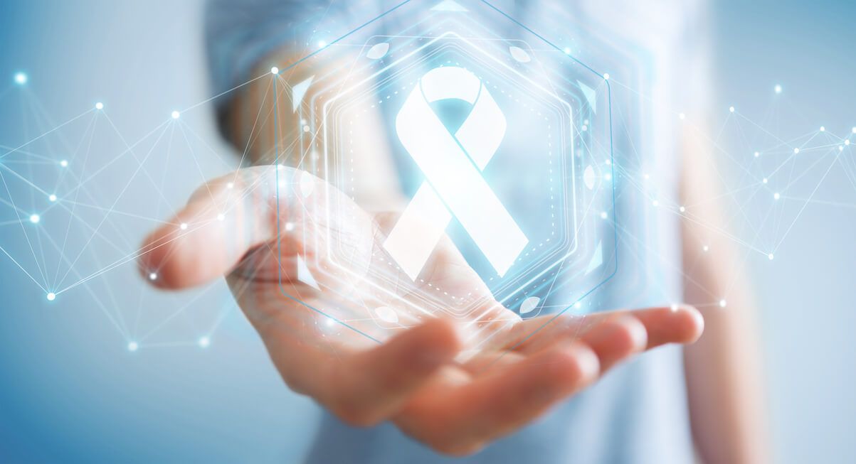El estudio DIPCAN busca cambiar el tratamiento del cáncer metastásico en España con datos de 2000 pacientes