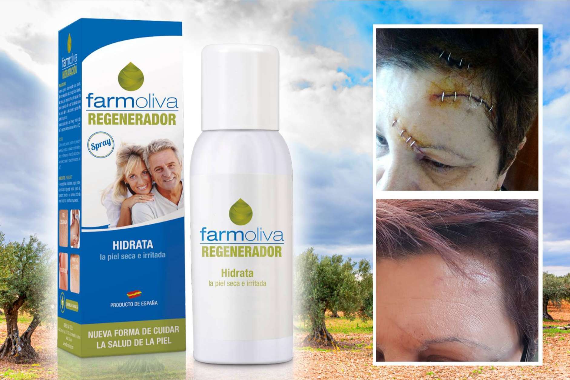 Los beneficios de Farmoliva Regenerador, el spray de Farmoliva que ayuda a la piel a regenerarse de manera natural para mantenerla sana