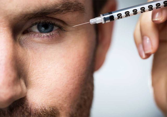 beneficios botox Merca2.es