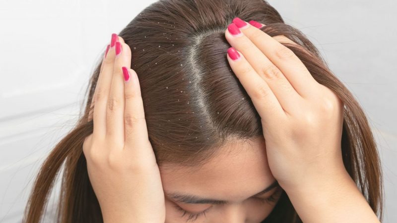 caspa pelo Merca2.es