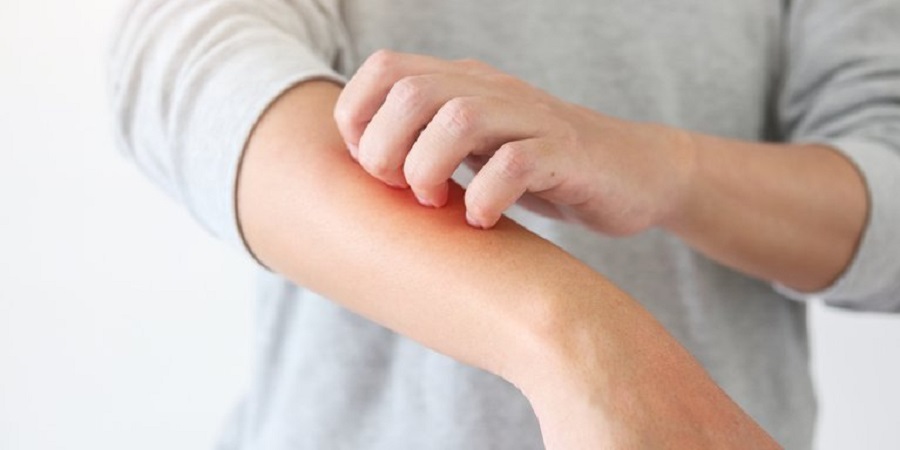 La dermatitis atópica, la enfermedad crónica de la piel más frecuente en la infancia La dermatitis atópica, la enfermedad crónica de la piel más frecuente en la infancia