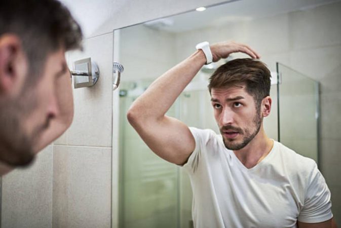 El asombroso motivo que no te creerás por el que tu pelo se puede llenar de caspa 43 Merca2.es El asombroso motivo que no te creerás por el que tu pelo se puede llenar de caspa