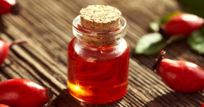 Trucos caseros para que no te salgan estrías 34 Merca2.es image 259 Merca2.es